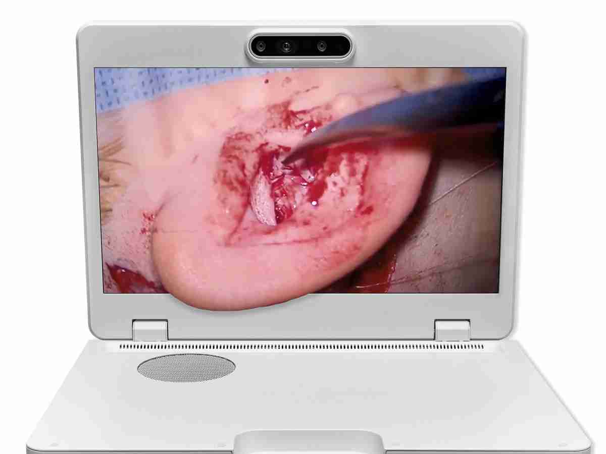 达擎之＂Heads-up 3D显微手术显示系统＂，，，，整合4K裸眼3D显示及眼球追踪系统，，具备快速追踪人眼移动位置功能，，，减轻医师长时间维持固定姿势的负担，，让医师能有更宽广清晰的3D立体视野及更舒适的姿势来执行手术。。